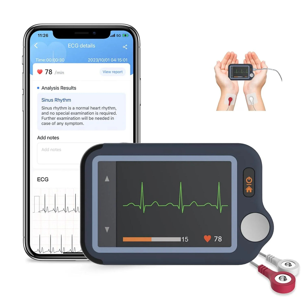 Modèle Appareil ECG au format portable pour Usage Domestique 30s 60s 5min CheckMe Plus, Moniteur ECG Bluetooth avec Affichage en Temps Réel